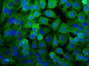 Anti-LDHA Rabbit Polyclonal Antibody