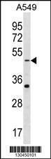 Anti-GABRR2 Rabbit Polyclonal Antibody (Biotin)