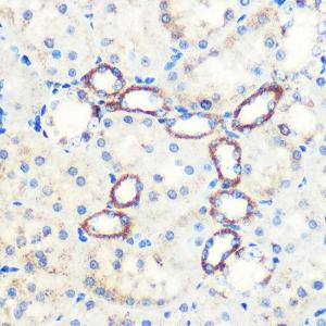 Immunohistochemistry analysis of paraffin-embedded rat kidney using Anti-SAV1 Antibody (A306668) at a dilution of 1:100 (40X lens). Perform microwave antigen retrieval with 10 mM PBS buffer pH 7.2 before commencing with IHC staining protocol