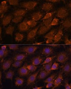 Immunofluorescence analysis of C6 cells using Anti-CREB3 Antibody (A11991) at a dilution of 1:100. DAPI was used to stain the cell nuclei (blue).