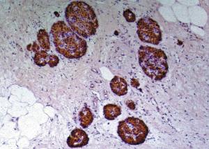 Anti-C-peptide of Proinsulin antibody