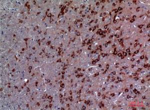 Immunohistochemical analysis of paraffin-embedded rat brain using Anti-TRPC3 Antibody