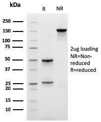 Anti-Carboxypeptidase A1 Mouse Monoclonal Antibody [clone: CPA1/2712]