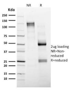 SDS-PAGE analysis of Anti-CD4 Antibody [CD4/1604] under non-reduced and reduced conditions; showing intact IgG and intact heavy and light chains, respectively. SDS-PAGE analysis confirms the integrity and purity of the antibody