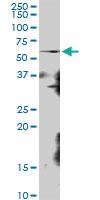 Anti-RRP8 Mouse Polyclonal Antibody