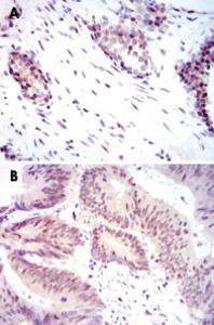 Anti-YAP1 Mouse Monoclonal Antibody [clone: 1A12]