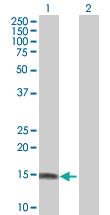 Anti-STK32A Mouse Polyclonal Antibody