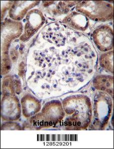 Anti-VPS54 Rabbit Polyclonal Antibody (FITC (Fluorescein Isothiocyanate))