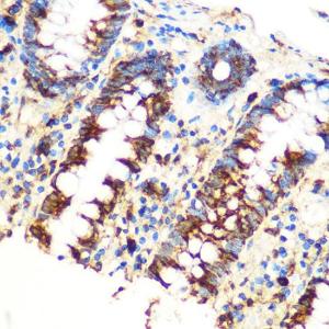 Immunohistochemistry analysis of paraffin-embedded human colon tissue using Anti-SAV1 Antibody (A306668) at a dilution of 1:100 (40X lens). Perform microwave antigen retrieval with 10 mM PBS buffer pH 7.2 before commencing with IHC staining protocol