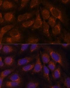 Immunofluorescence analysis of U-2 OS cells using Anti-CREB3 Antibody (A11991) at a dilution of 1:100. DAPI was used to stain the cell nuclei (blue).