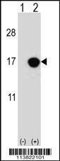 Anti-CDKN2B Rabbit Polyclonal Antibody (APC (Allophycocyanin))