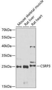 Western blot analysis of extracts of various cell lines, using Anti-CSRP3 Antibody (A11992) at 1:1,000 dilution. The secondary antibody was Goat Anti-Rabbit IgG H&L Antibody (HRP) at 1:10,000 dilution.