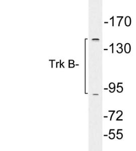 Western blot analysis of lysates from K562 cells using Anti-Trk B Antibody