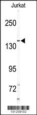 Anti-MAP3K14 Rabbit Polyclonal Antibody