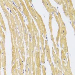 Immunohistochemistry analysis of paraffin-embedded mouse heart using Anti-CSRP3 Antibody (A11992) at a dilution of 1:100 (40x lens)