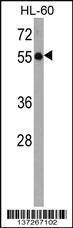 Anti-KLHL3 Rabbit Polyclonal Antibody