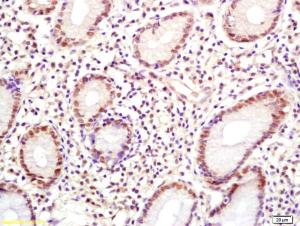 Anti-HPV33 E6 Rabbit Polyclonal Antibody