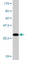 Anti-RAD1 Mouse Monoclonal Antibody [clone: 1A12]