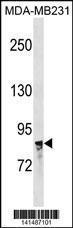 Anti-NR3C1 Rabbit Polyclonal Antibody