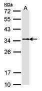 Anti-TPM1 Rabbit Polyclonal Antibody