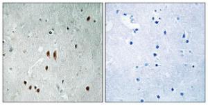 Immunohistochemical analysis of paraffin-embedded human brain using Anti-CNOT2 (phospho Ser101) Antibody. The right hand panel represents a negative control, where the antibody was pre-incubated with the immunising peptide