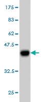 Anti-TNNI3 Mouse Monoclonal Antibody [clone: 1E7]