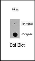 Anti-EP300 Rabbit Polyclonal Antibody (AP (Alkaline Phosphatase))