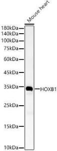 Western blot analysis of Mouse heart, using Anti-HOXB1 Antibody (A11994) at 1:4,000 dilution. The secondary antibody was Goat Anti-Rabbit IgG H&L Antibody (HRP) at 1:10,000 dilution.