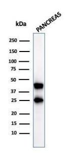 Anti-Carboxypeptidase A1 Mouse Monoclonal Antibody [clone: CPA1/2712]