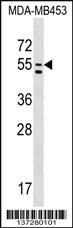 Anti-PTDSS1 Rabbit Polyclonal Antibody