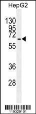 Anti-GAD1 Rabbit Polyclonal Antibody (FITC (Fluorescein Isothiocyanate))