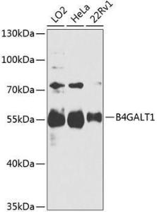 Western blot analysis of extracts of various cell lines, using Anti-B4GALT1 Antibody (A306673) at 1:1,000 dilution