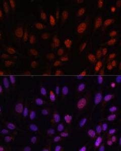 Immunofluorescence analysis of U-2 OS cells using Anti-HOXB1 Antibody (A11994) at a dilution of 1:100. DAPI was used to stain the cell nuclei (blue).