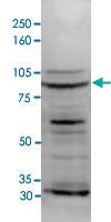 Anti-DNMT3B Rabbit Polyclonal Antibody