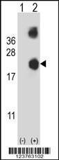 Anti-DSTN Rabbit Polyclonal Antibody (APC (Allophycocyanin))