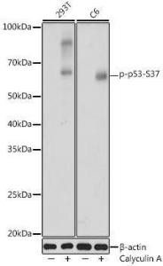 Western blot analysis of extracts of various cell lines, using Anti-p53 (phospho Ser37) Antibody (A306674) at 1:1,000 dilutio