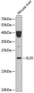 Western blot analysis of extracts of mouse liver, using Anti-IL-20 Antibody (A11996) at 1:1,000 dilution The secondary antibody was Goat Anti-Rabbit IgG H&L Antibody (HRP) at 1:10,000 dilution Lysates/proteins were present at 25 µg per lane