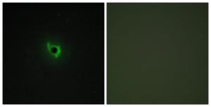 Immunofluorescence analysis of COS7 cells using Anti-EPHA6 Antibody. The right hand panel represents a negative control, where the antibody was pre-incubated with the immunising peptide.