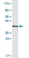 Anti-HNMT Mouse Monoclonal Antibody [clone: 2G12]