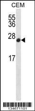 Anti-CDKN2B Rabbit Polyclonal Antibody (Biotin)