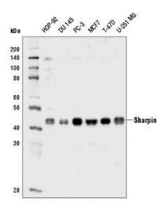 Anti-SHARPIN Rabbit Monoclonal Antibody [clone: 13G65]