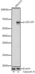 Western blot analysis of extracts of NIH/3T3 cells, using Anti-p53 (phospho Ser37) Antibody (A306674) at 1:1,000 dilutio