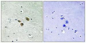 Immunohistochemical analysis of paraffin-embedded human brain using Anti-ME3 Antibody 1:100 (4°C overnight). The right hand panel represents a negative control, where the antibody was pre-incubated with the immunising peptide.