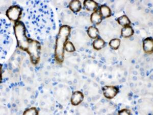 Anti-CASR Antibody