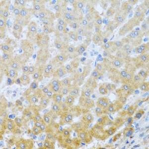 Immunohistochemistry analysis of paraffin-embedded human liver using Anti-IL-20 Antibody (A11996) at a dilution of 1:100 (40x lens) Perform microwave antigen retrieval with 10 mM PBS buffer pH 72 before commencing with IHC staining protocol