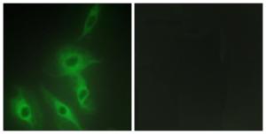 Immunofluorescence analysis of HeLa cells using Anti-AS250 Antibody. The right hand panel represents a negative control, where the Antibody was pre-incubated with the immunising peptide