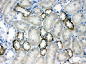 Anti-CASR Antibody