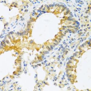 Immunohistochemistry analysis of paraffin-embedded mouse lung using Anti-IL-20 Antibody (A11996) at a dilution of 1:100 (40x lens) Perform microwave antigen retrieval with 10 mM PBS buffer pH 72 before commencing with IHC staining protocol