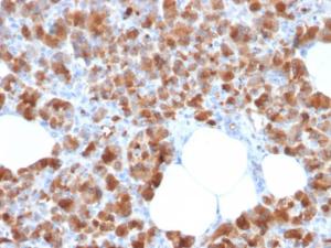 Immunohistochemical analysis of formalin-fixed, paraffin-embedded human pancreas using Anti-Carboxypeptidase A1 Antibody [CPA1/2713]