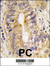 Anti-PDGFRA Rabbit Polyclonal Antibody (FITC (Fluorescein))